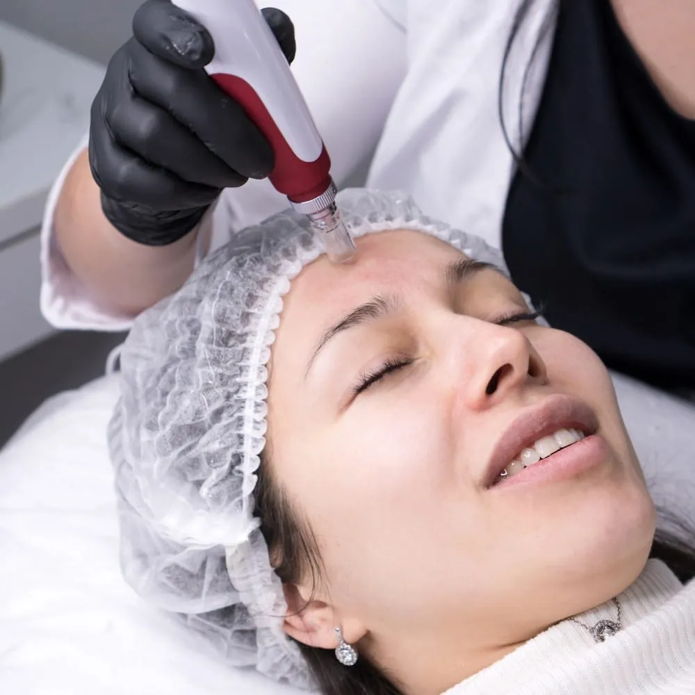 Procell Microchanneling advanced skin treatment in Cambridge ON