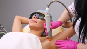 Laser Hair Removal for Underarms